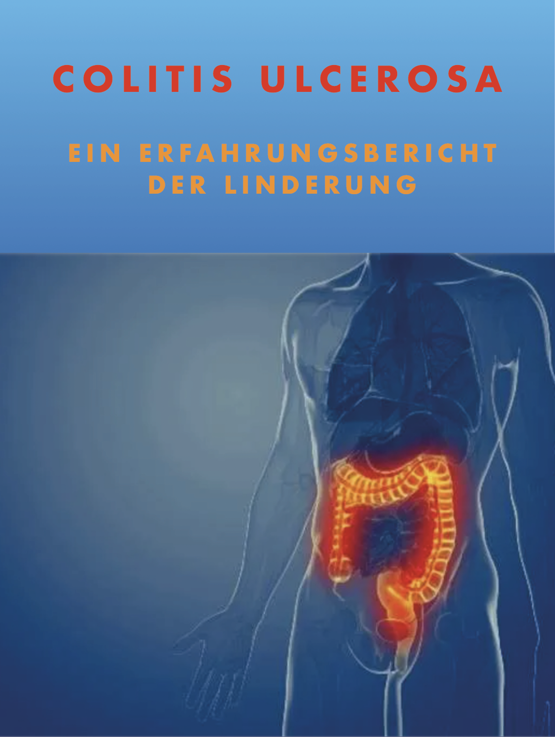 Titelbild von E-Book colitis ulcerosa